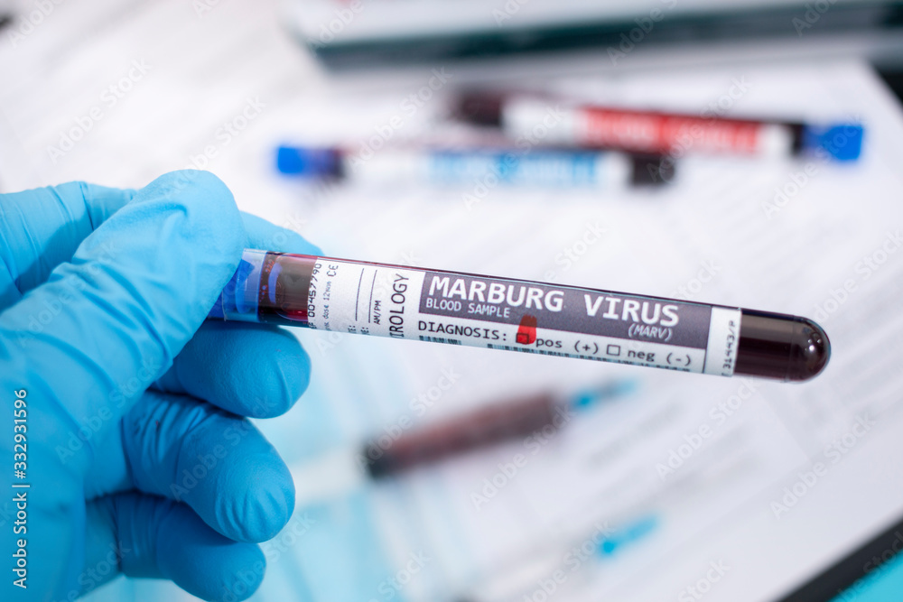 Fototapeta premium Blood samples with infected virus