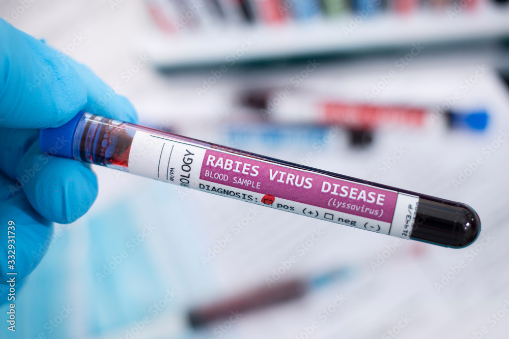 Fototapeta premium Blood samples with infected virus