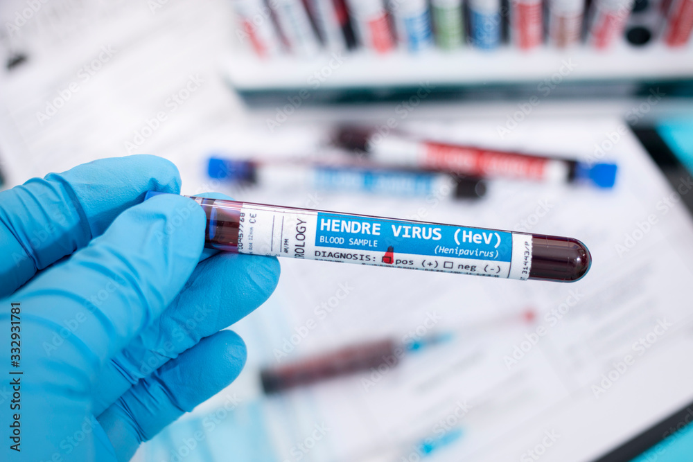 Fototapeta premium Blood samples with infected virus