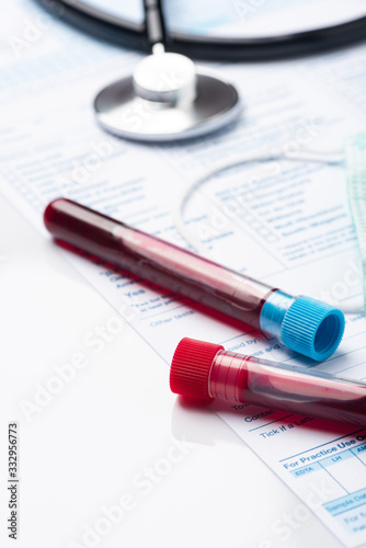 Blood Test Samples for Presence of Coronavirus (COVID-19) Tube Containing a Blood Sample from Patient