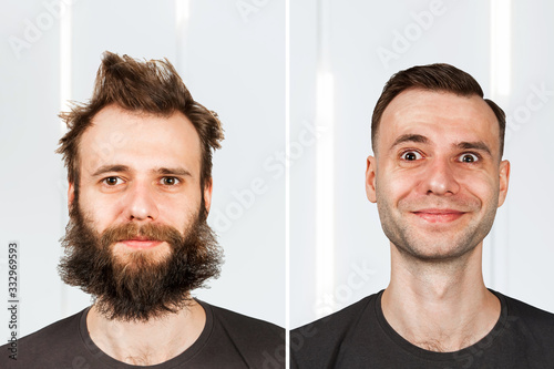 happy guy with beard and without hair loss. Man before and after shave or transplant. haircut set transformation.