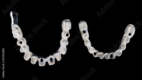 two dental titanium beams with apak material on the lower and upper jaws of the patient, shot from above on a black background photo