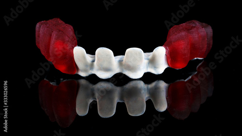 titanium dental beam in apak material, with temporary red wax crowns on the chewing part, shot on a black background with reflection photo