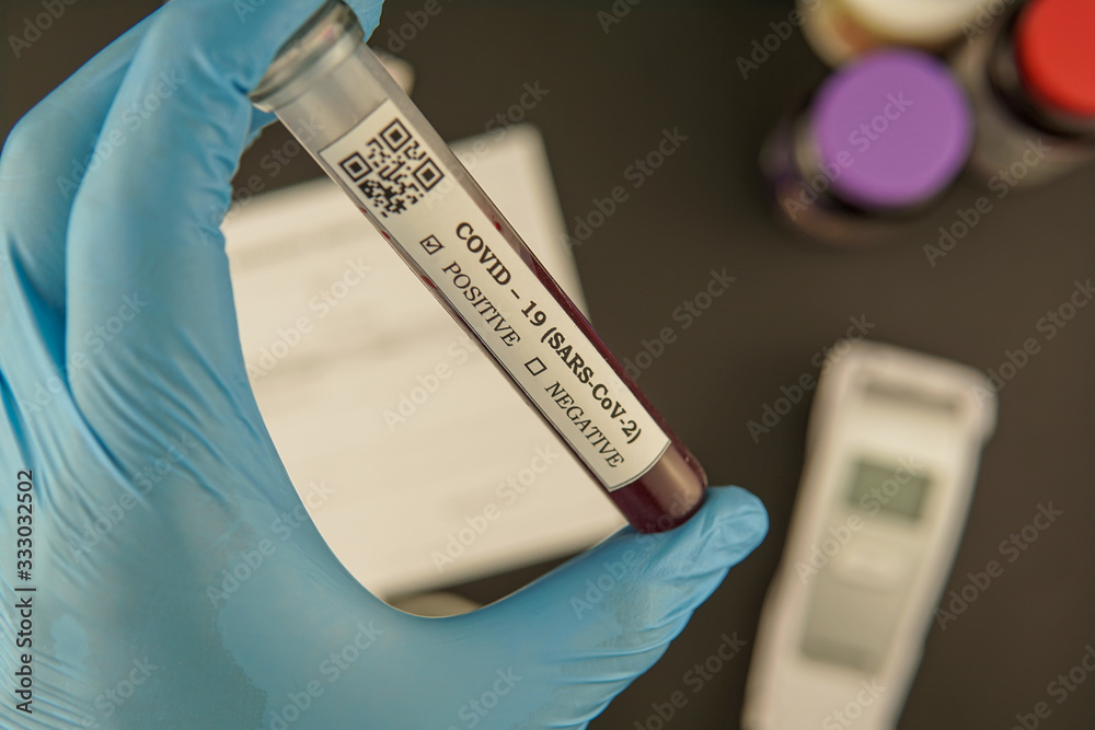 Hand holding test tube blood sample