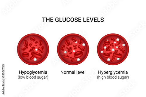 Vector illustration of glucose levels in the blood. 