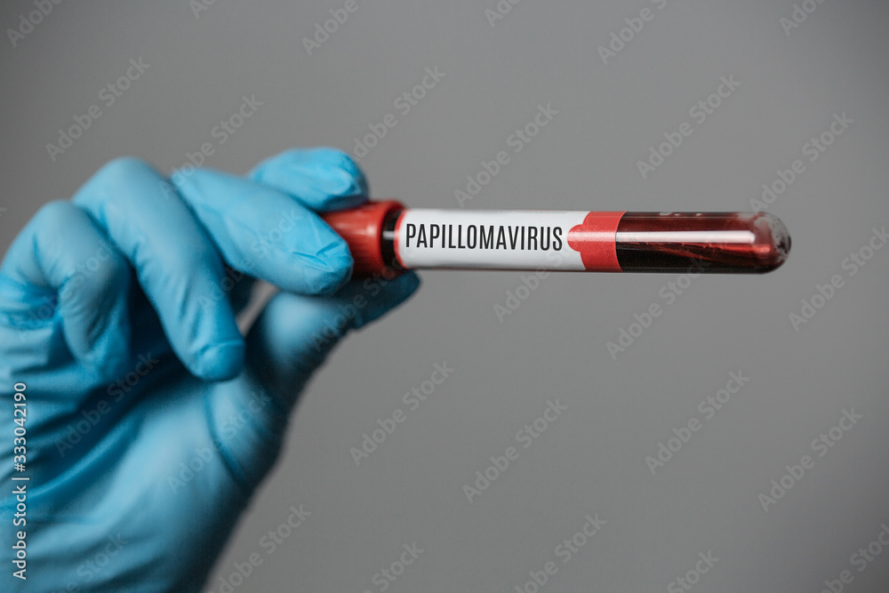 Fototapeta premium Nurse in rubber gloves Holding Blood Sample.