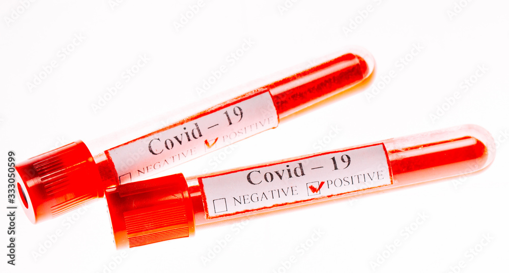 Positive blood Tests for Coronavirus in test tubes. Positive blood Tests for Coronavirus in test tubes.