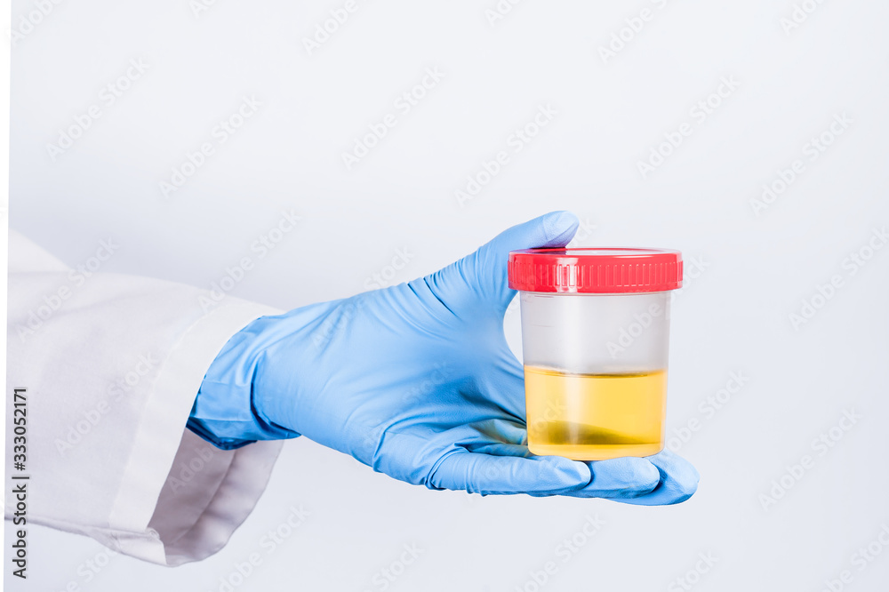 test tube with a urine test in the doctor's gloved hand test tube with a urine test in the doctor's gloved hand