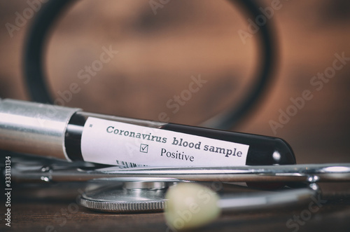 Coronavirus 2019-nCoV Blood Sample . Epidemic virus Respiratory Syndrome stock photo. Test tube with Blood Test  novel Coronavirus 2019 disease COVID-19 nCoV 