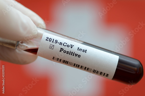 Stock photo of holding tube with Blood Test (novel Coronavirus 2019 disease,COVID-19,nCoV) and Flag of Switzerland. Switzerland virus outbreak.