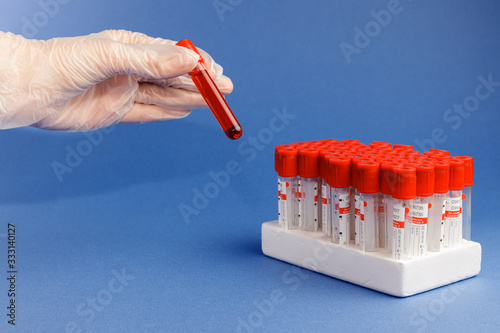 Hand holding testing patients blood samples for virus ion blue backgfound. New coronavirus 2019-nCoV concept, empty space isolated on blue panorama banner. photo