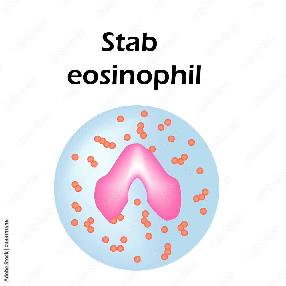 Eosinophil structure. Eosinophil blood cells. White blood cells. leukocytes. Infographics. Vector illustration on isolated background. Eosinophil structure. Eosinophil blood cells. White blood cells. leukocytes. Infographics. Vector illustration on isolated background.