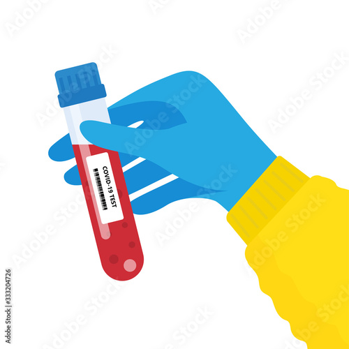Hand holds a test tube containing a blood sample, test tube with blood for Covid-19