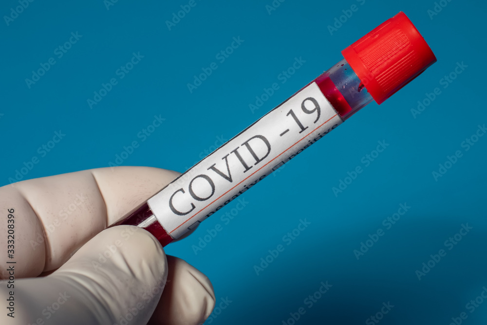 Obraz premium COVID-19 test on the blue background