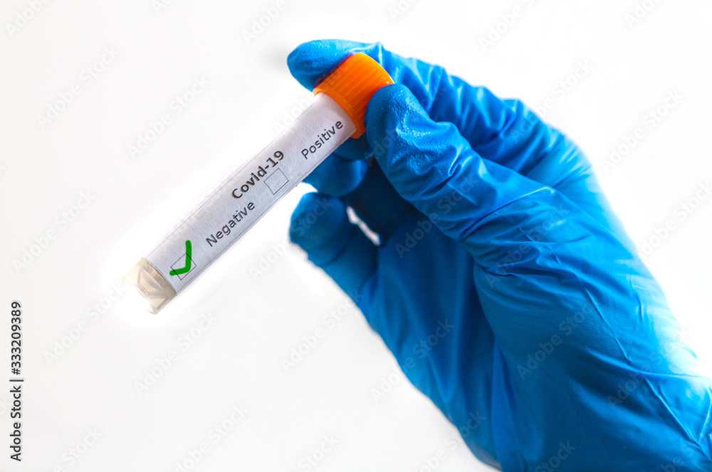 Obraz premium Abstrichröhrchen zum testen für den Coronavirus