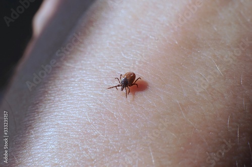 Female tick ( Ixodes scapularis) crawling on skin ready to bite 