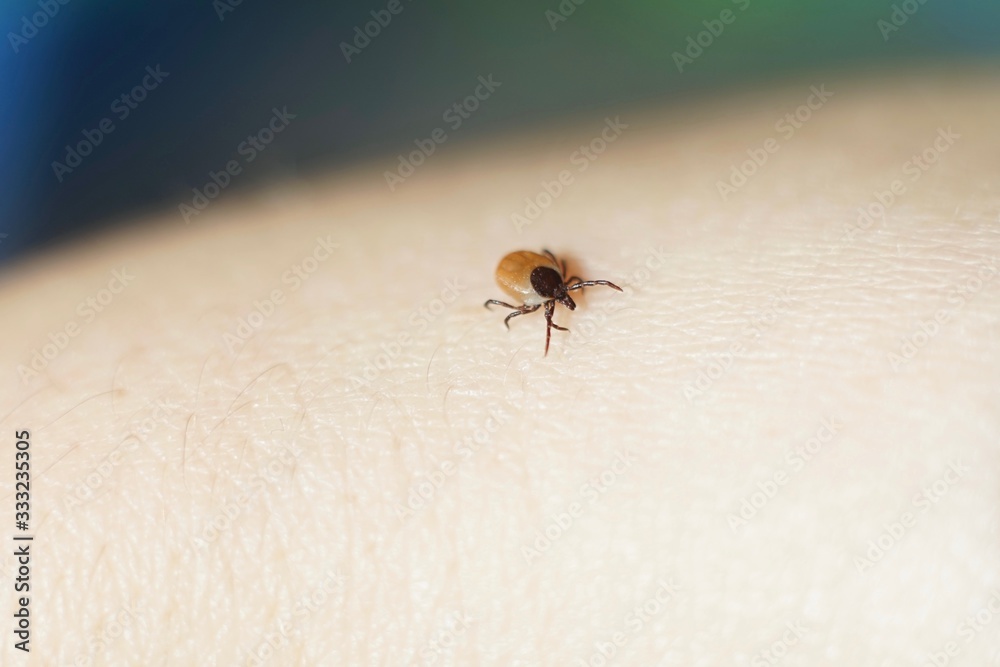Female tick ( Ixodes scapularis) crawling on skin ready to bite Female tick ( Ixodes scapularis) crawling on skin ready to bite