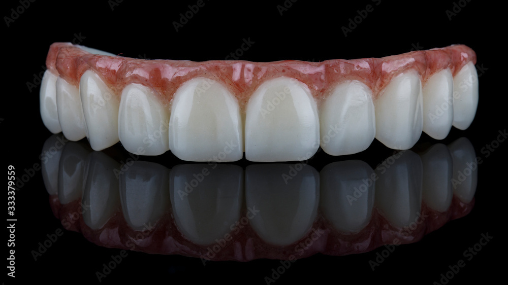 beautiful macro photo of a dental prosthesis of the upper jaw on black glass with reflection beautiful macro photo of a dental prosthesis of the upper jaw on black glass with reflection