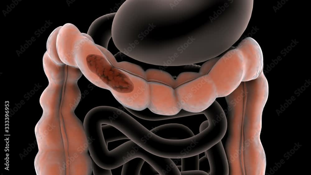 Biomedical animation of a healthy bowel movement in the human digestive system.