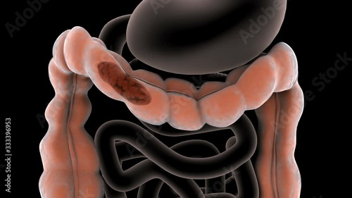 Biomedical animation of a healthy bowel movement in the human digestive system. photo