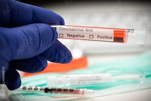 Blood test for COVID-19. Examination of a blood sample for the presence of SARS-CoV-2 coronavirus photo