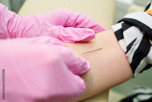 a nurse or doctor draws blood from a vein for a detailed biochemical analysis.