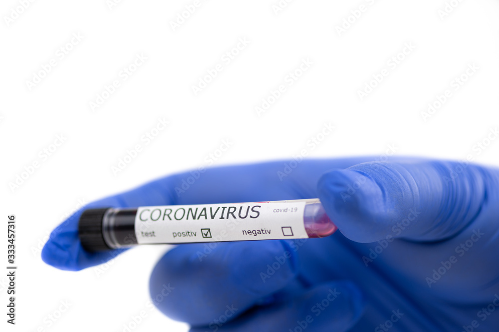 Fototapeta premium Hand with blue protective gloves holds blood sample tested positive with coronavirus