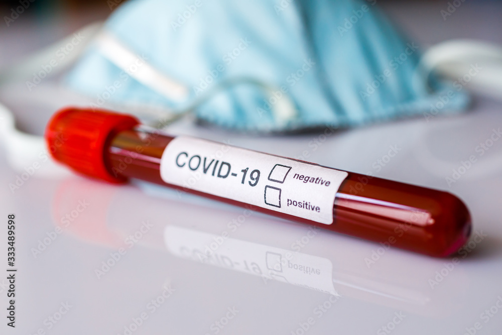 Obraz premium Coronavirus 2019 nCoV positive or negative blood test. Focus on result. Closeup.