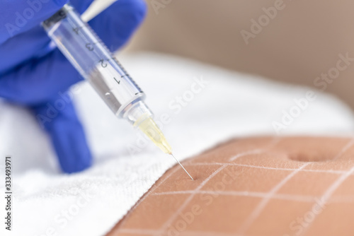 anti cellulite injection