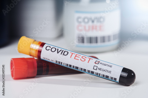 Blood test tube for 2019 nCoV analysis. Coronavirus COVID-19 vaccine glass bottle in the laboratory. Cure for coronavirus un a test tube. Chinese corona virus blood test concept.
