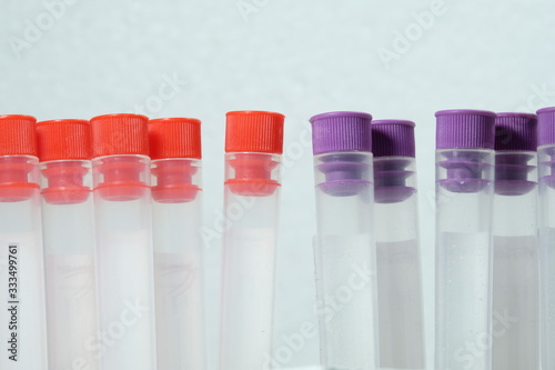 purple and red blood collection tubes in the middle White background