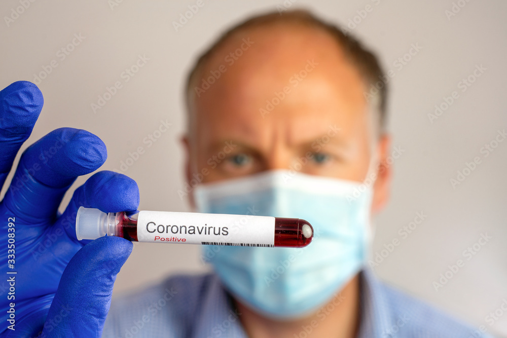A serious man wearing protective mask and showing positive result of coronavirus test. A serious man wearing protective mask and showing positive result of coronavirus test.