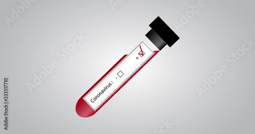 Positive Covid-19 test. Transparent glass test tube filled with blood. White vignette with coronavirus inscription. Animated red check mark at positive subtitle. Gray gradient background.