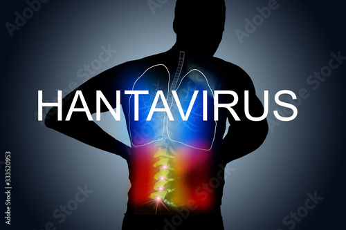 Text hantavirus. Emergency concept. Hanta virus, HPS virus infection pulmonary syndrome HPS. outbreak continues to spread outside China.