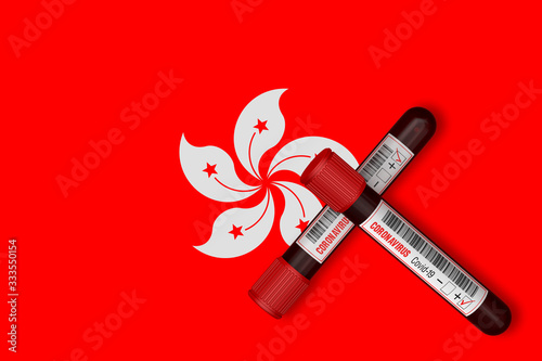 Photography Test tubes with the Inscription 2019-nCoV on the background of the Hong Kong Flag
