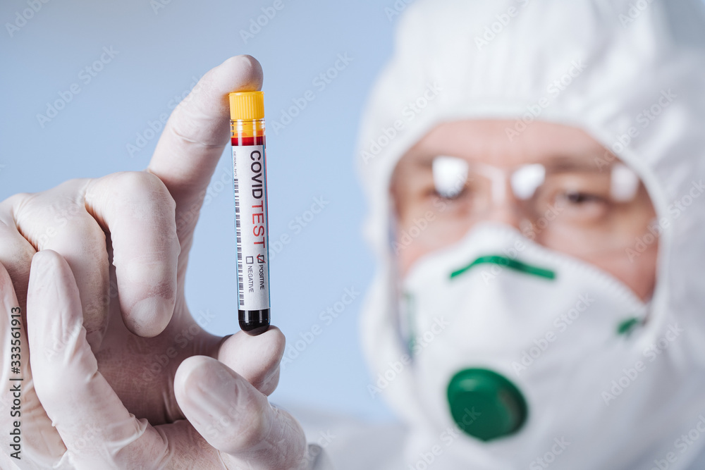 Doctor with a tube of biological sample contaminated by Coronavirus with label Covid Test. A breakthrough in the procedure. Pandemic. Doctor with a tube of biological sample contaminated by Coronavirus with label Covid Test. A breakthrough in the procedure. Pandemic.