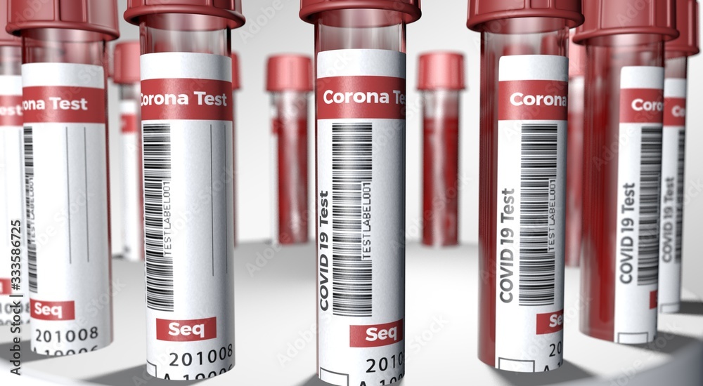 Covid19-Test tube - Medical Corona Virus Test - visualization Covid19-Test tube - Medical Corona Virus Test - visualization