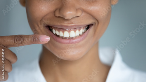 Close up african woman point finger at perfect straight hollywood white toothy smile. After whitening dental treatment procedure showing result, health stomatology dentistry service, oralcare concept photo