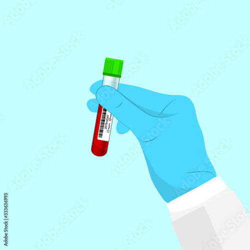 Close up of scientist holding tube for 2019-nCoV analyzing.Coronavirus blood test Concept.