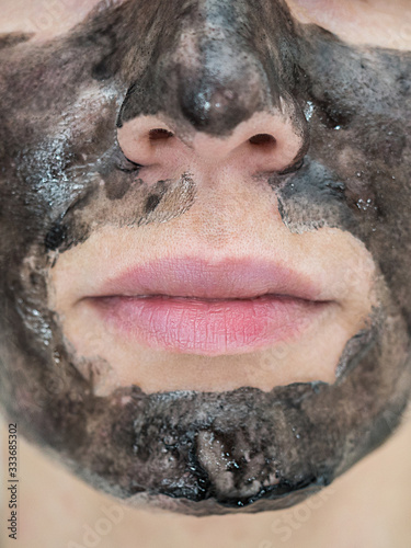 Close-up photo of the bottom of a female face with black peel off mask