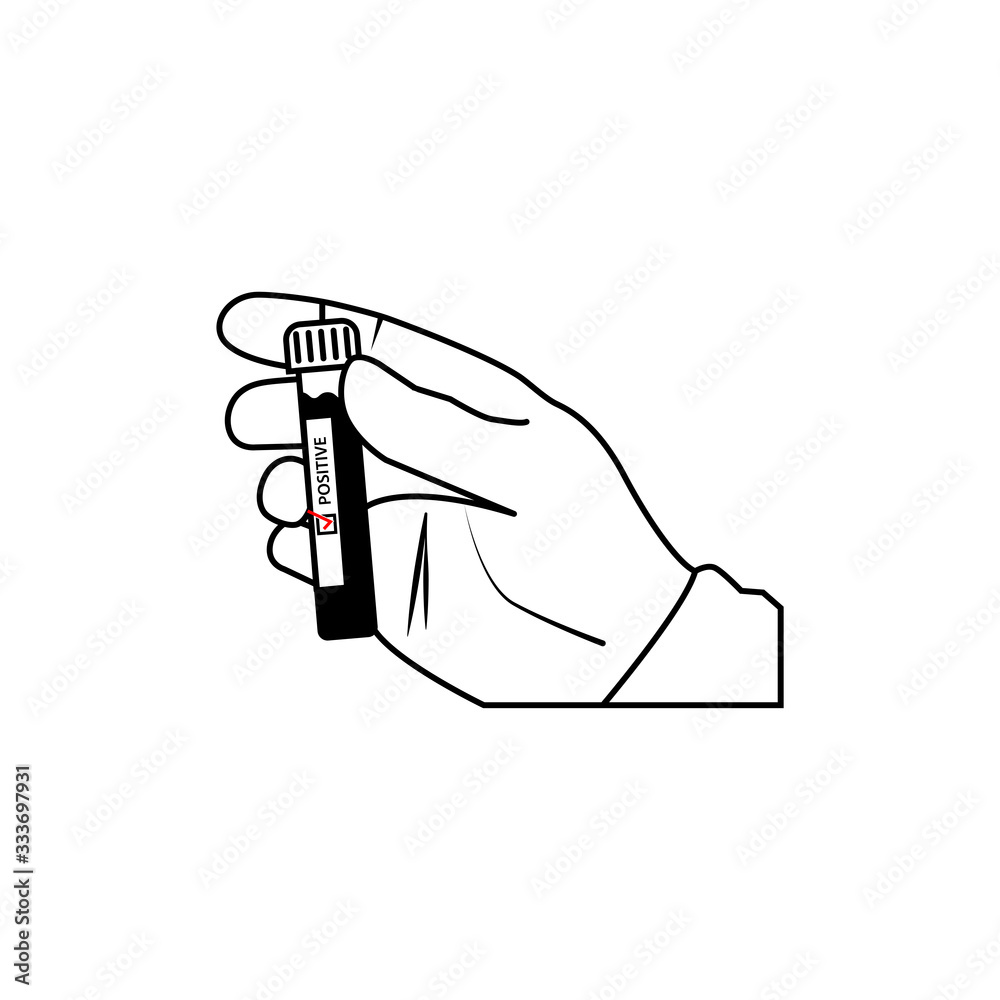 Test tube with blood sample positive SARS cronovirus