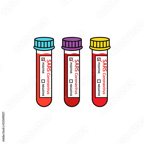 Test tube with blood sample positive SARS cronovirus