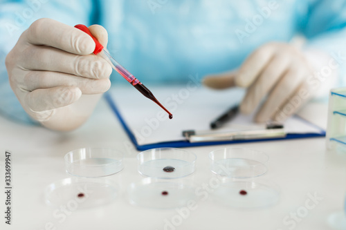 Close up view of a researcher s hands in a laboratory drips a blood sample into a Petri dish. Focus on the dropper.