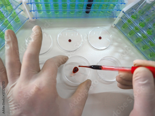 Photo of a pipette in a researcher's hands dripping a blood sampe in a Petri sish. Vaccine creation. photo