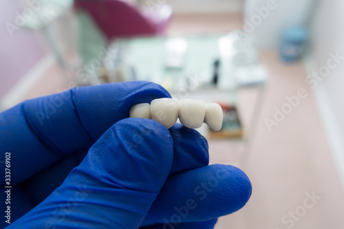 artificial dental structures in hands of a dentist