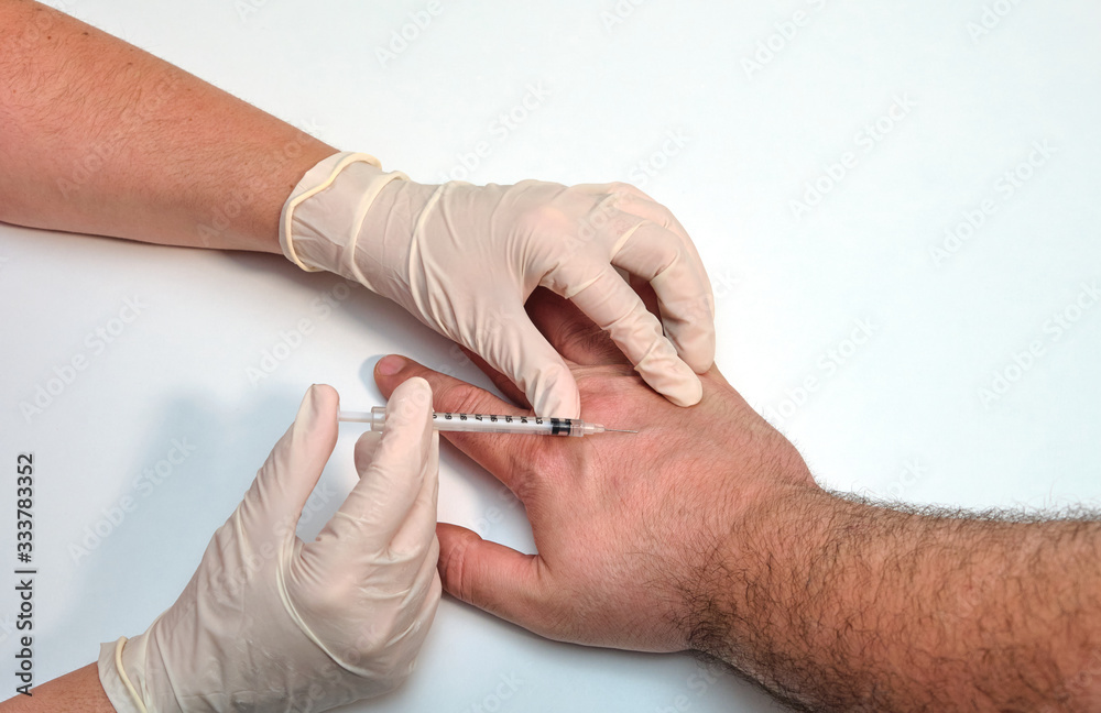 Puncture of a syringe in one hand