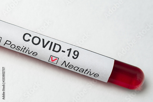 Tube of biological sample with label Covid-19. Negative analysis for coronavirus. close up photo