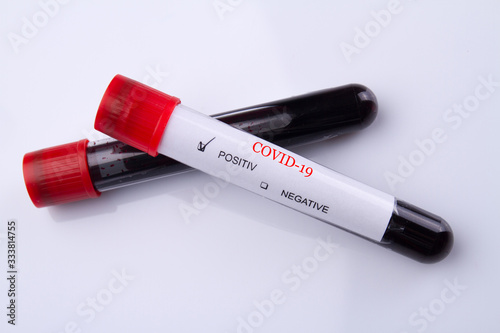 Two blood test tubes on white background. Close up blood with coronavirus COVID-19.