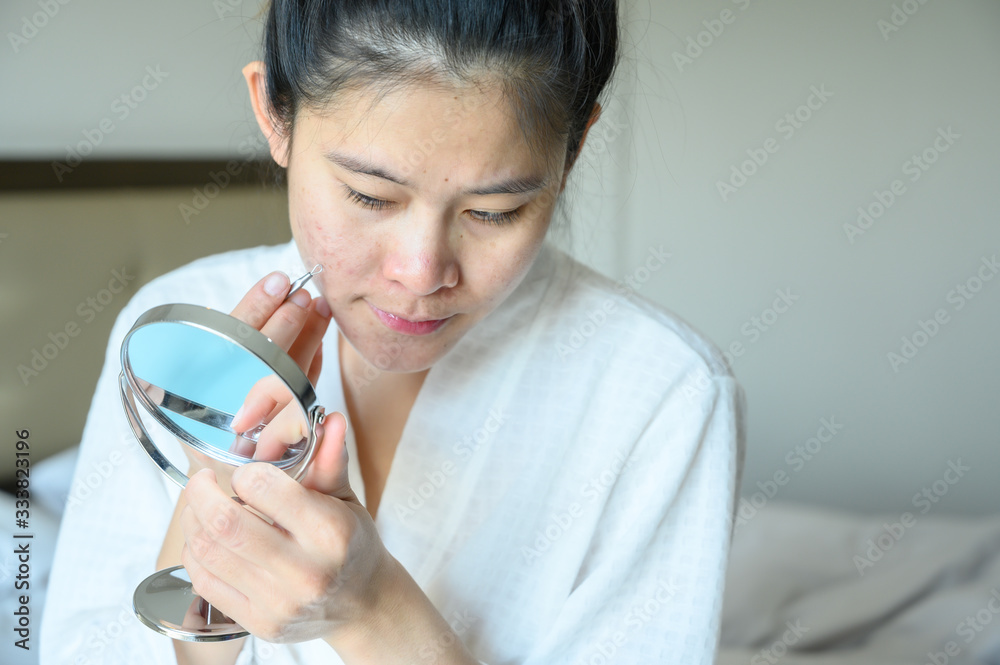 Portrait of Asian woman trying to squeeze acne by herself, using acne needle and looking mini mirror. Conceptual shot of Acne & Problem Skin on female face. Portrait of Asian woman trying to squeeze acne by herself, using acne needle and looking mini mirror. Conceptual shot of Acne & Problem Skin on female face.