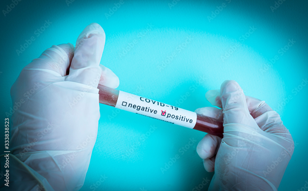 Fototapeta premium Hand holds a test tube containing a blood sample